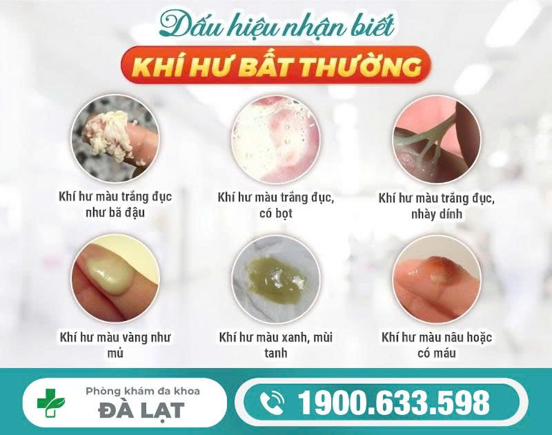 Hình ảnh minh họa